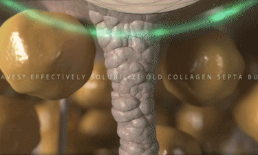640_wx_fmt=gif&from=appmsg&wxfrom=5&wx_lazy=1 (5).gif